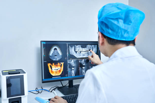 Best Emergency Tooth Extraction in Burlington, WA
